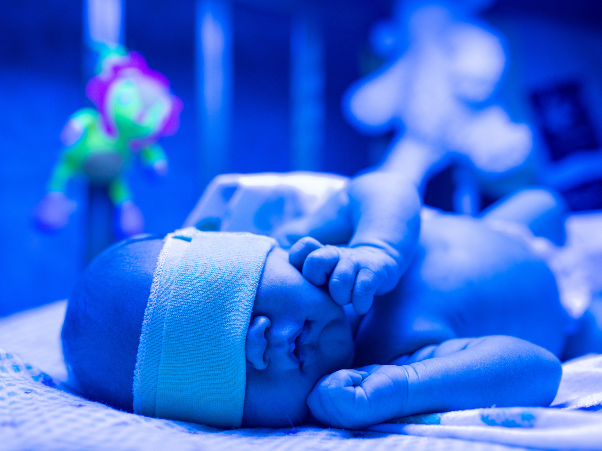 Understanding Newborn Jaundice: A Guide for New Moms